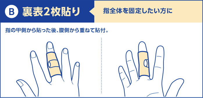 b)裏表2枚貼り：指全体を固定したい方に。指の甲側から貼った後、腹側から重ねて貼付。