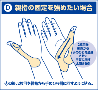 d)親指の固定を強めたい場合